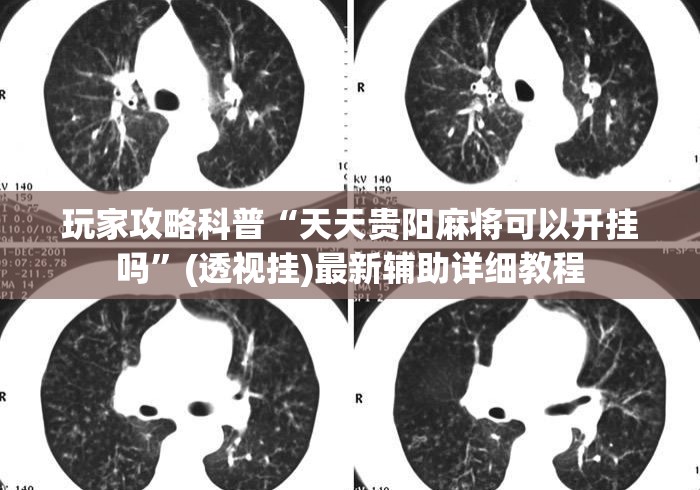 玩家攻略科普“天天贵阳麻将可以开挂吗	”(透视挂)最新辅助详细教程
